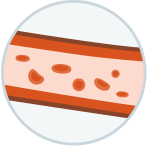 Illustration indicating fewer red blood cells